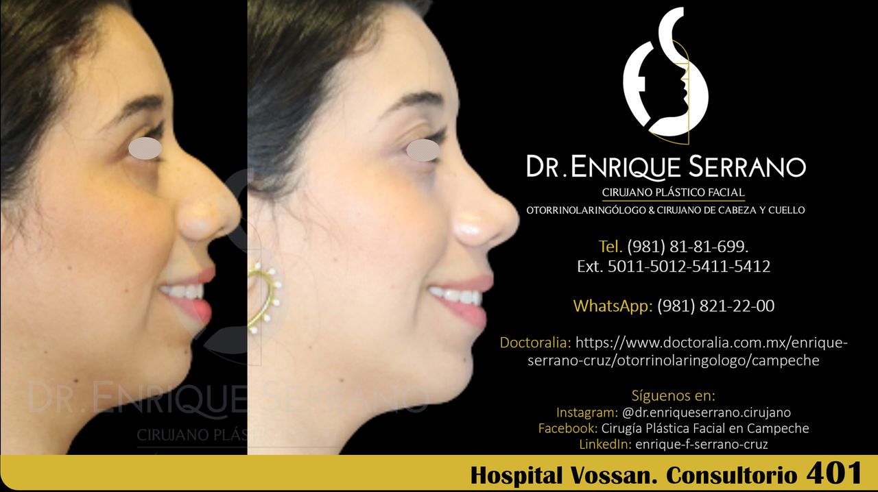 Enrique Serrano Cruz-118