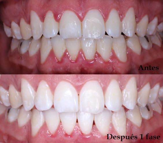 Ireri Rojas Bermúdez-7