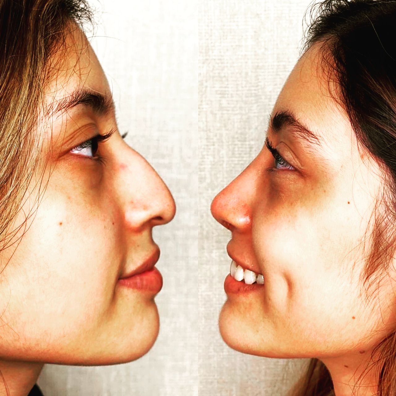 Carlos Alberto Ruiz Zepeda-44