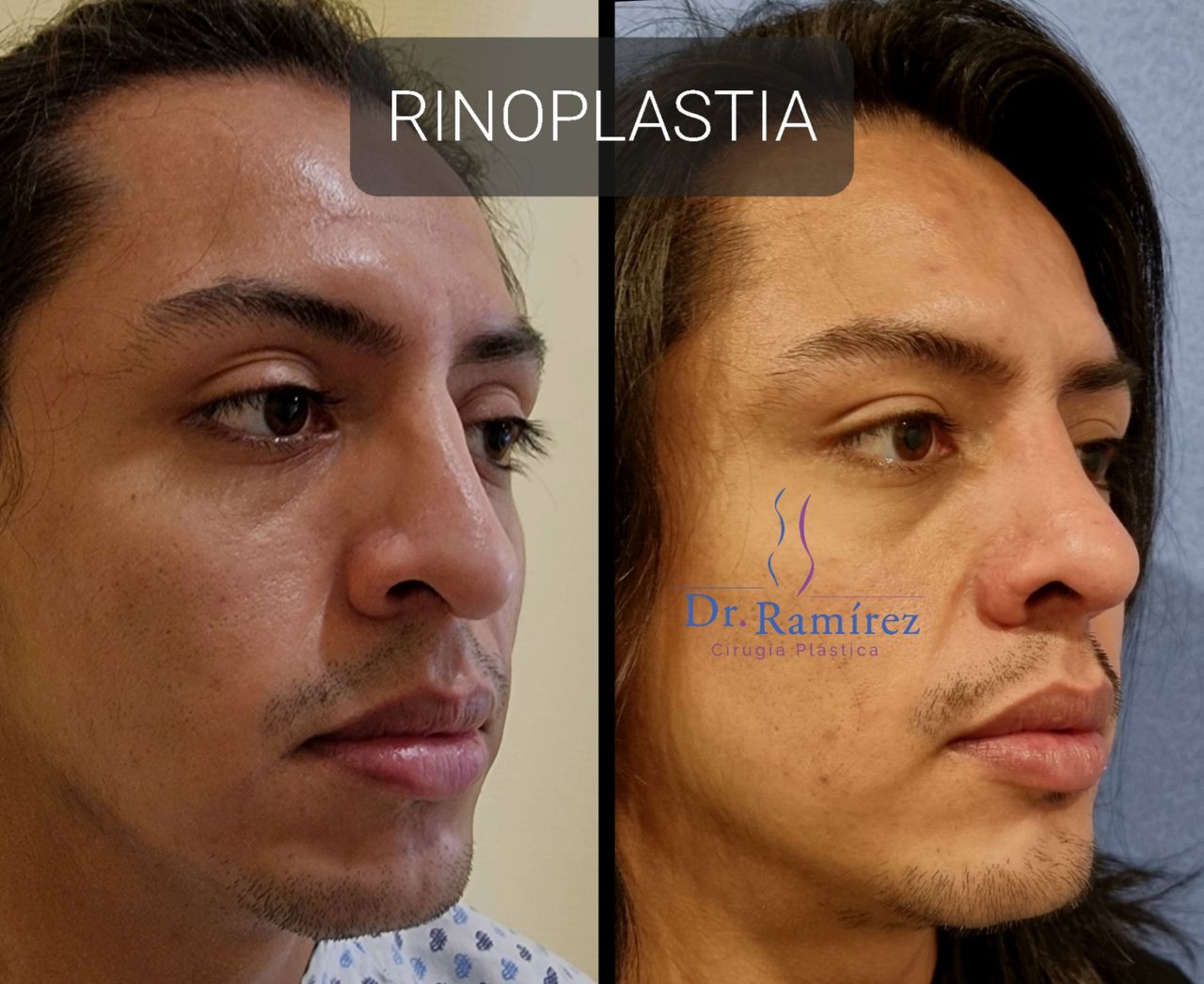 Edgar Ramírez López-18