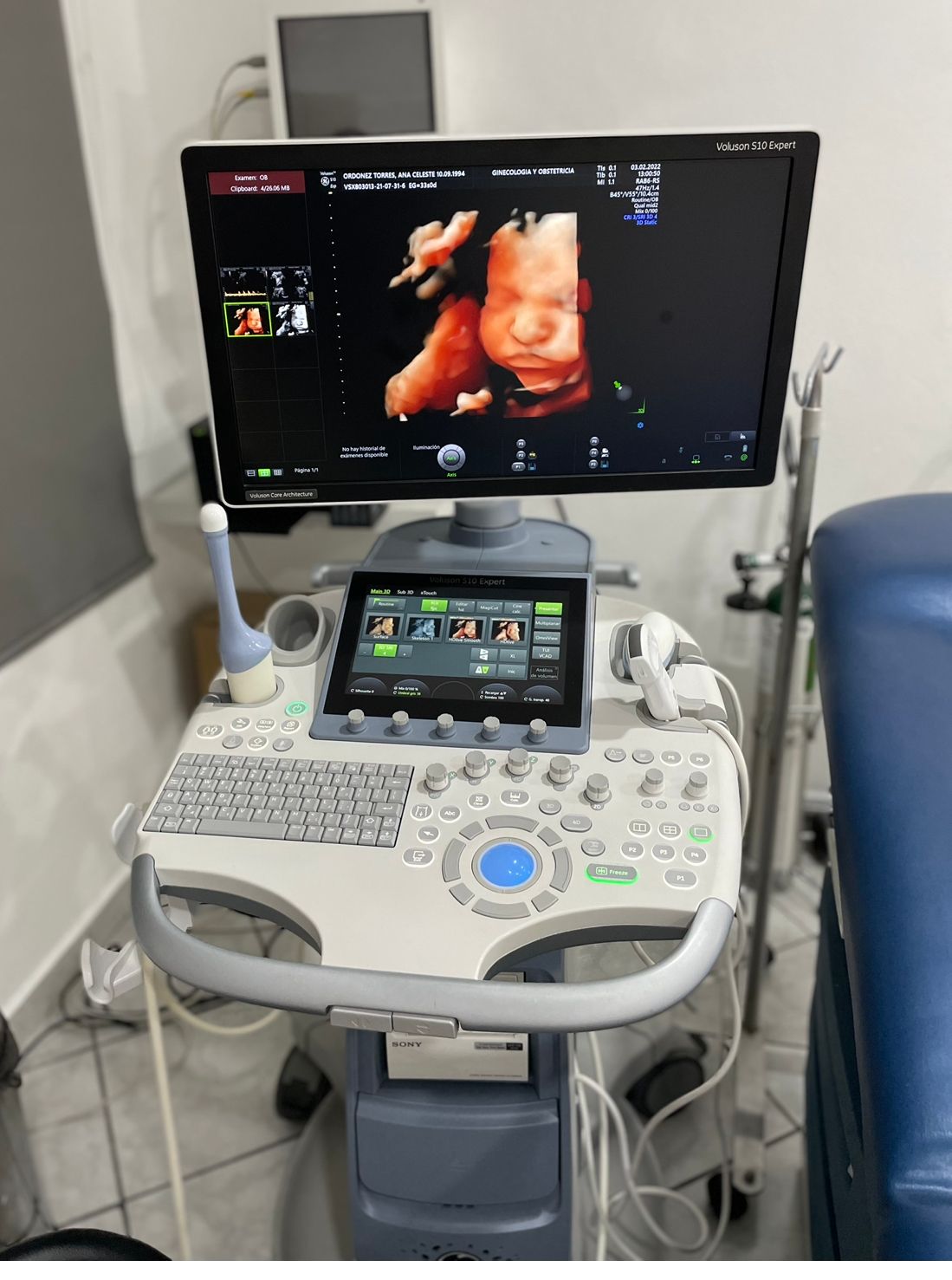 Juan Jose Pacheco Uc-2