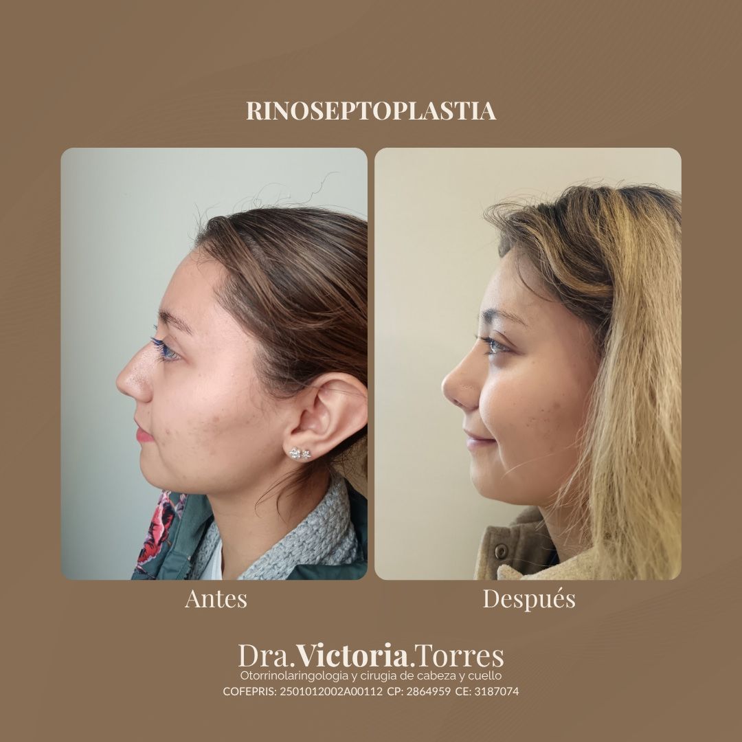 Estela Victoria Torres Galáz-9