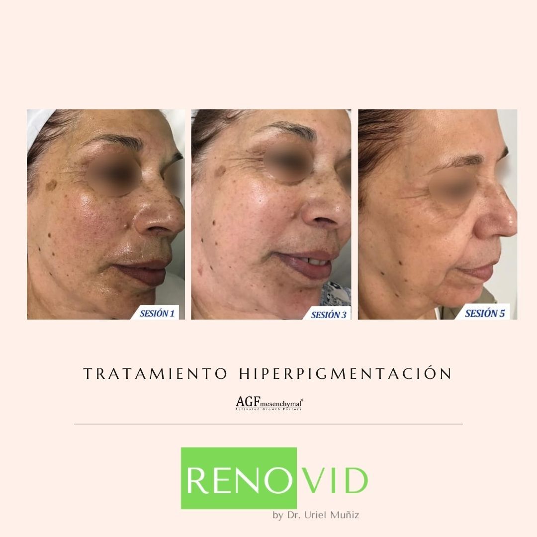 Teófilo Uriel Muñiz Chávez-55