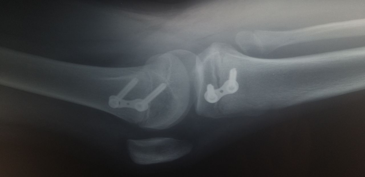 Jorge Armando Avila López-13