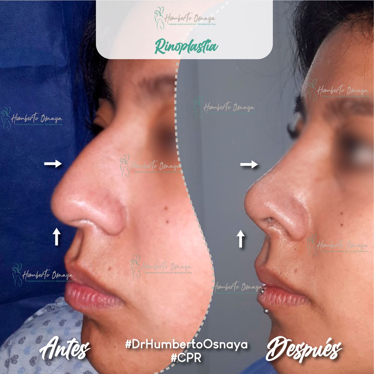 Humberto Osnaya Moreno-27