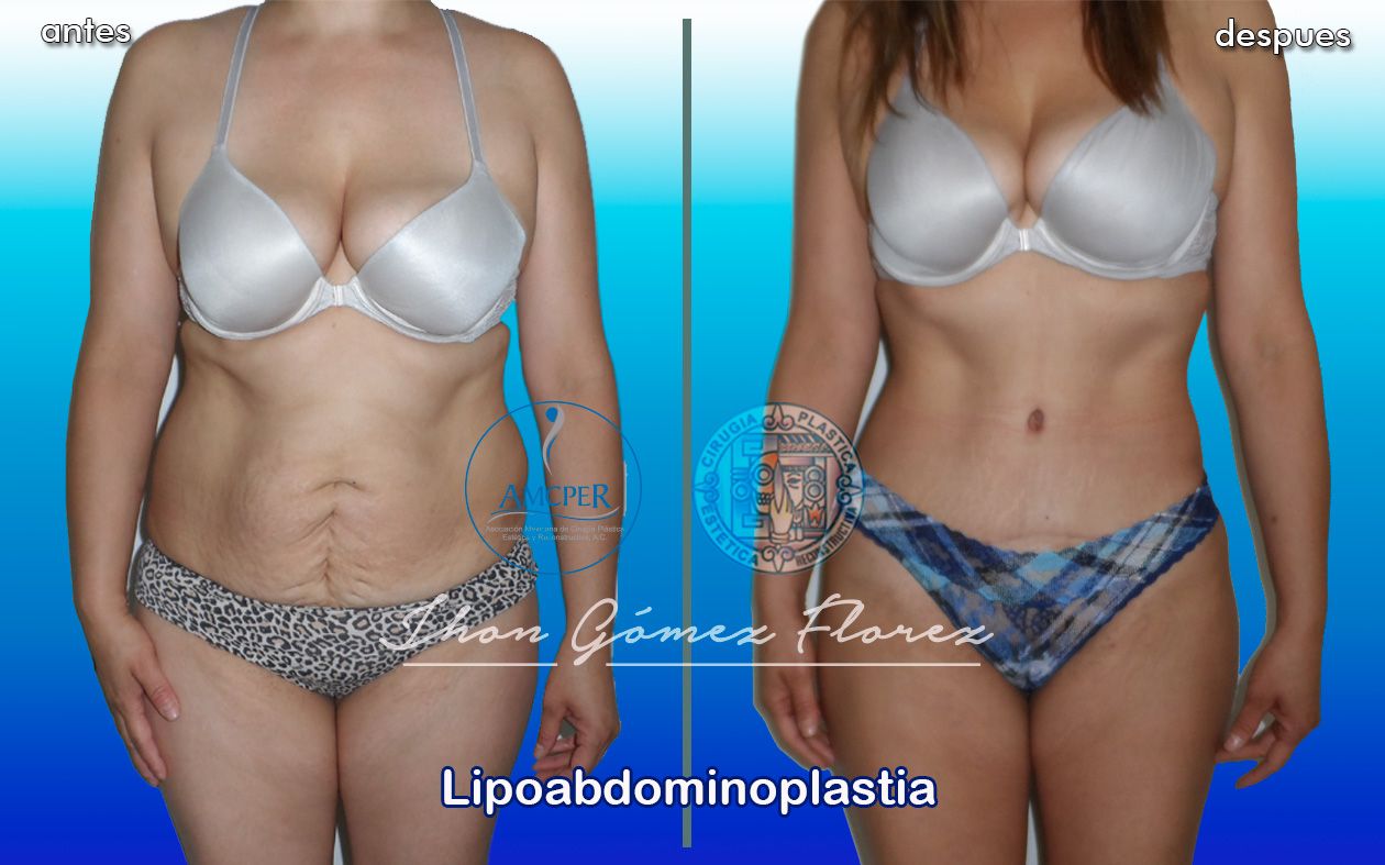 Jhon César Gómez Florez-45