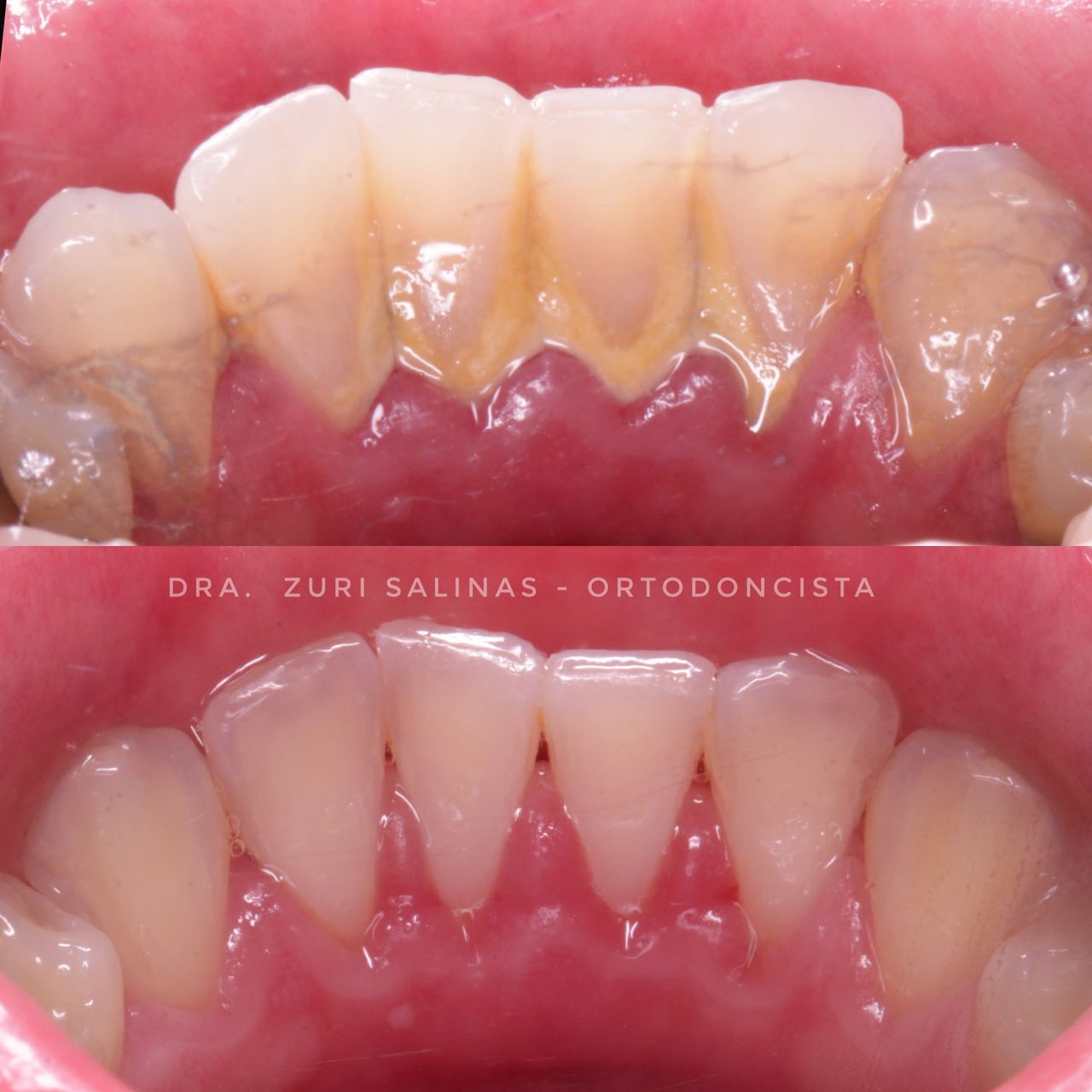 Zurisadai Salinas Chávez-2