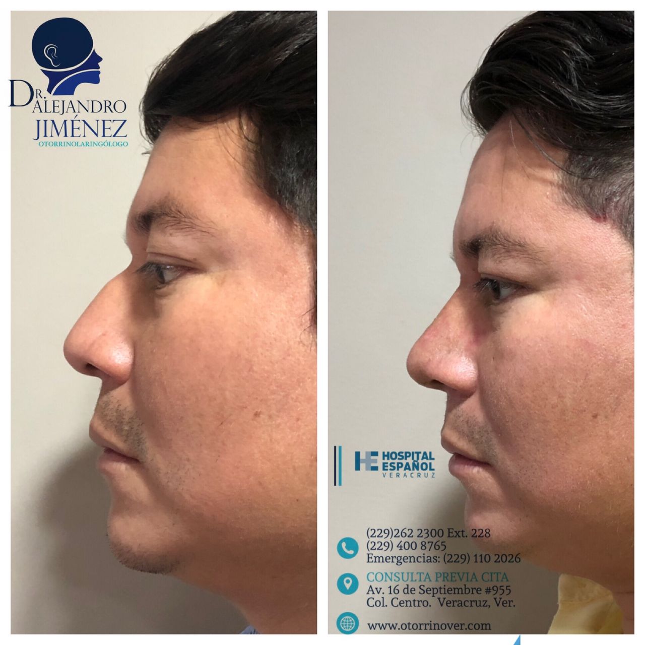 Alejandro Jimenez Garcia-25