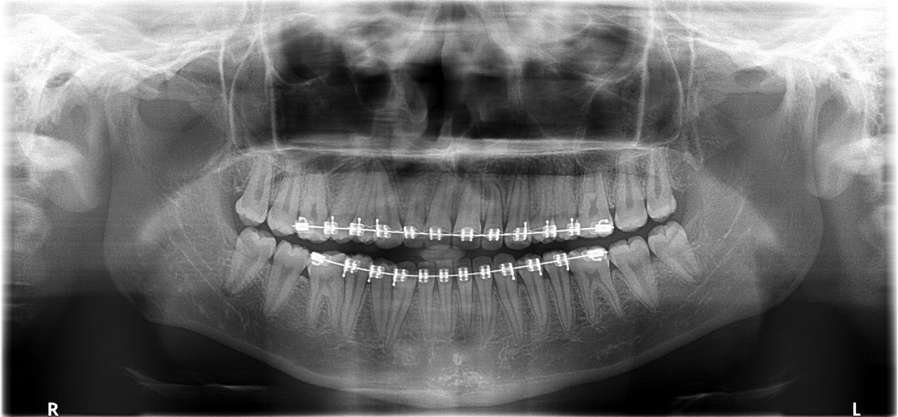 Omar Alejandro Ortiz Rodriguez-4