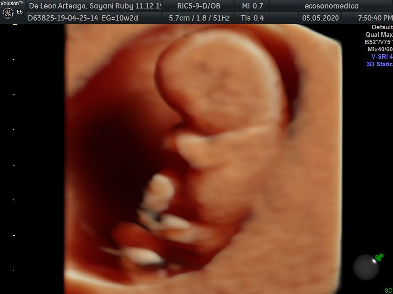 Héctor Bernardo Acevedo Manrique-19