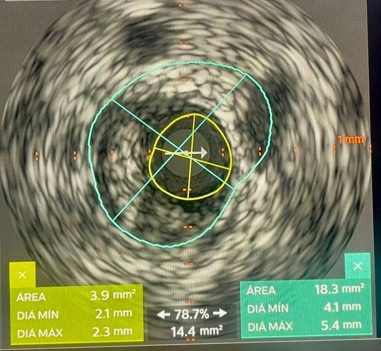 Abdón Ávila Chávez-50