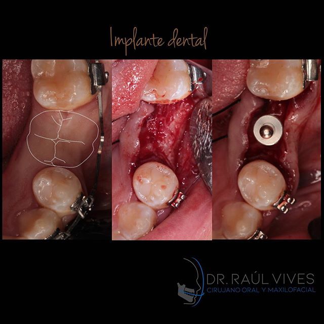 Raúl José Vives Serrano-13