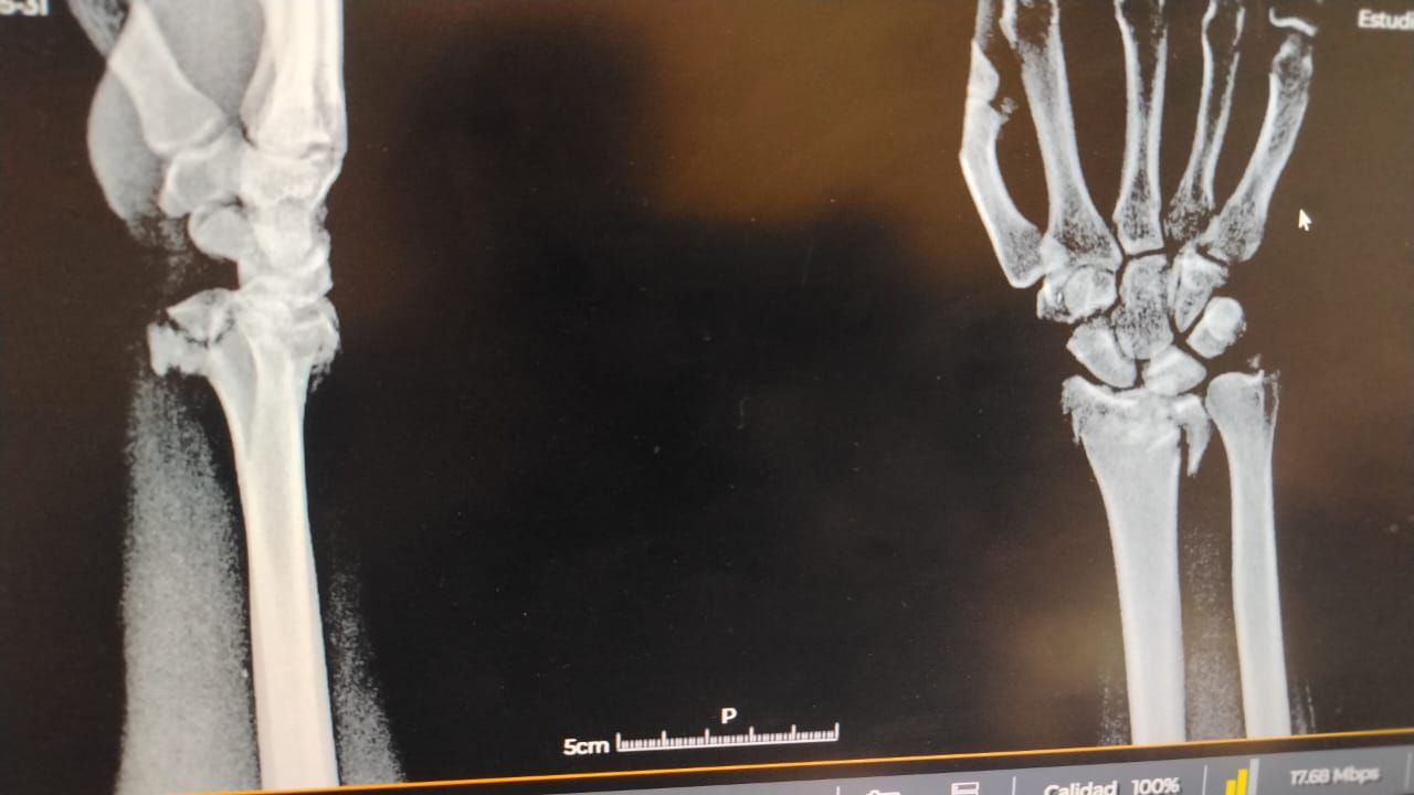 Alejandro Irisson-30