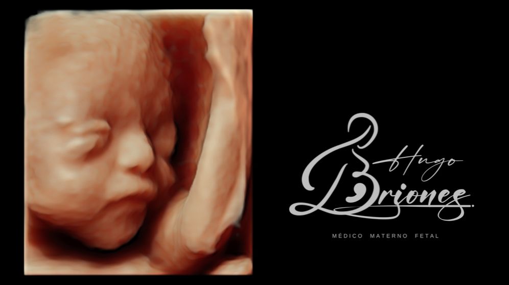 Hugo López Briones-6