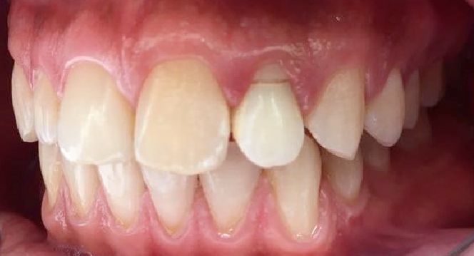 Esmeralda Candida Guerrero Pimentel-37