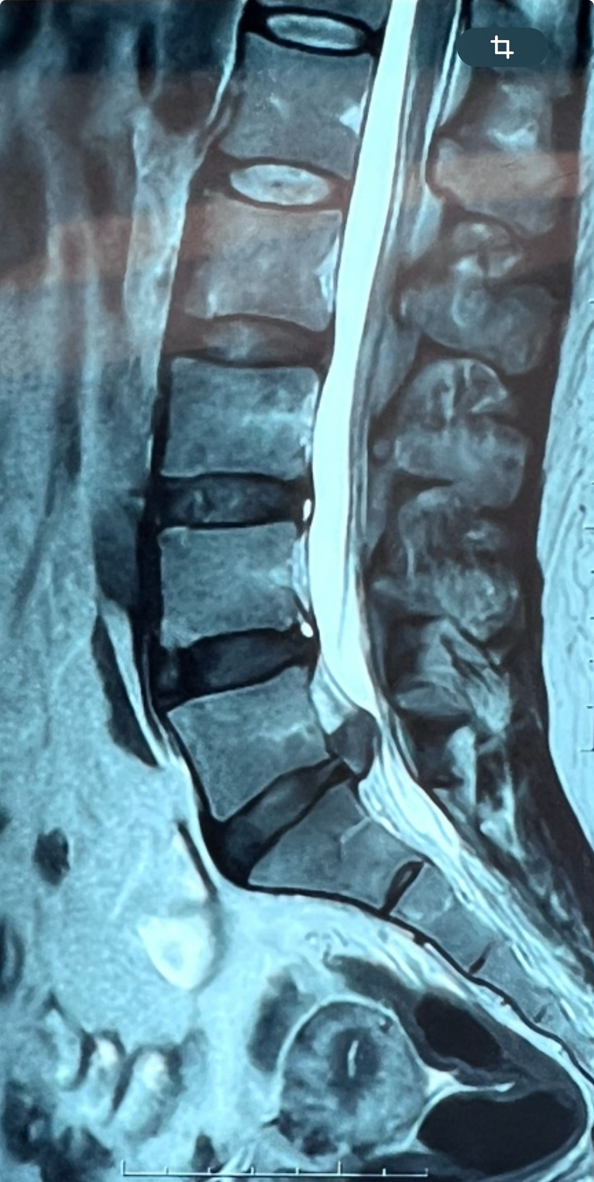 José Luis Sánchez Arellano-15