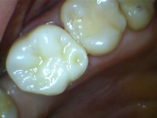 Jose David Torres Hernandez-19