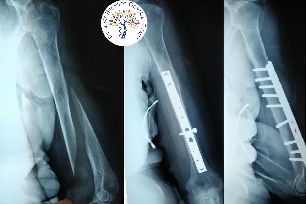 Jesús Humberto González Gómez-3