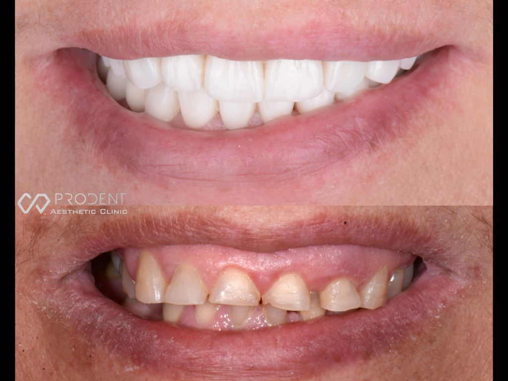 Ramiro Ivan Pérez Murillo-25