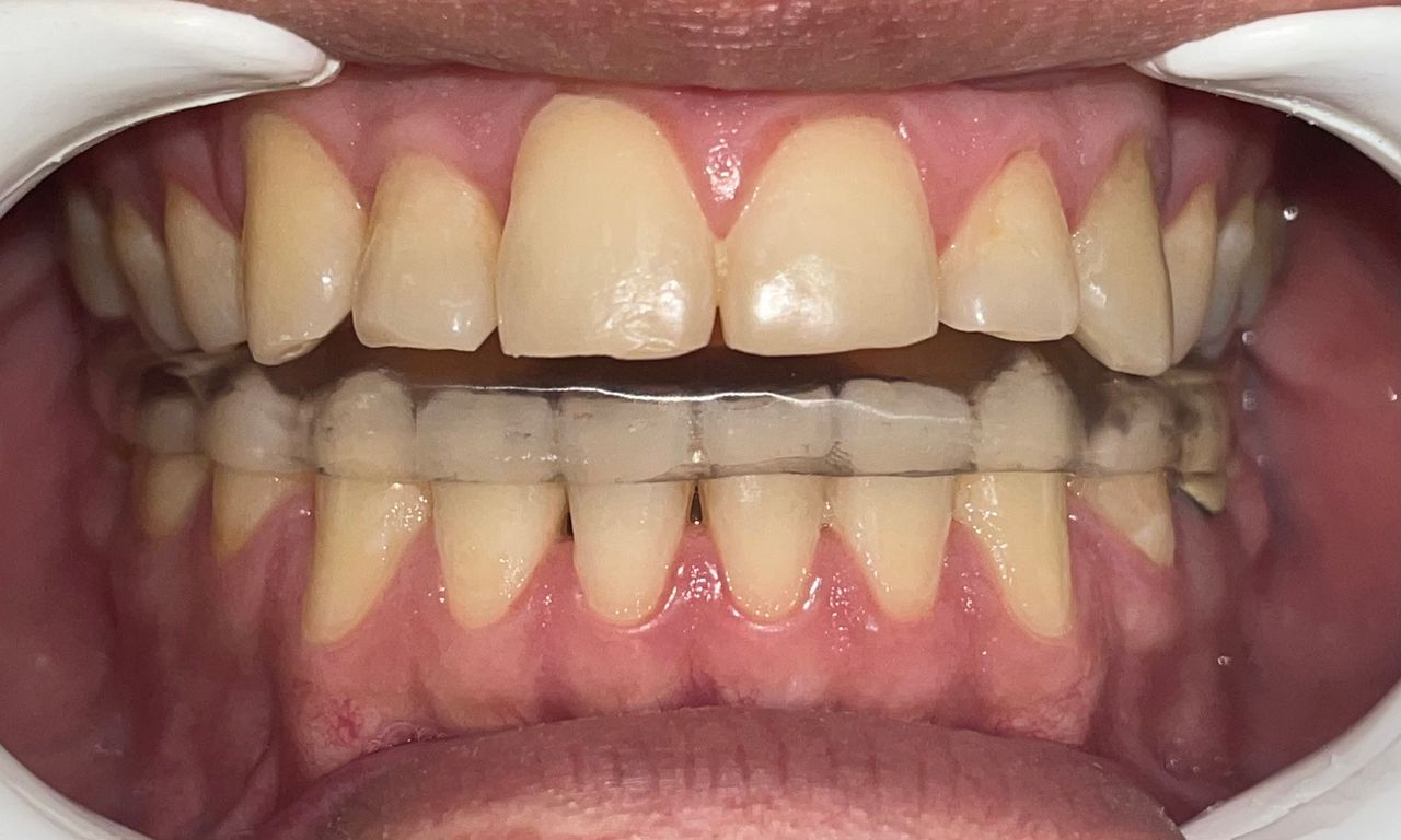 Luis Ernesto Calva Valdez-6