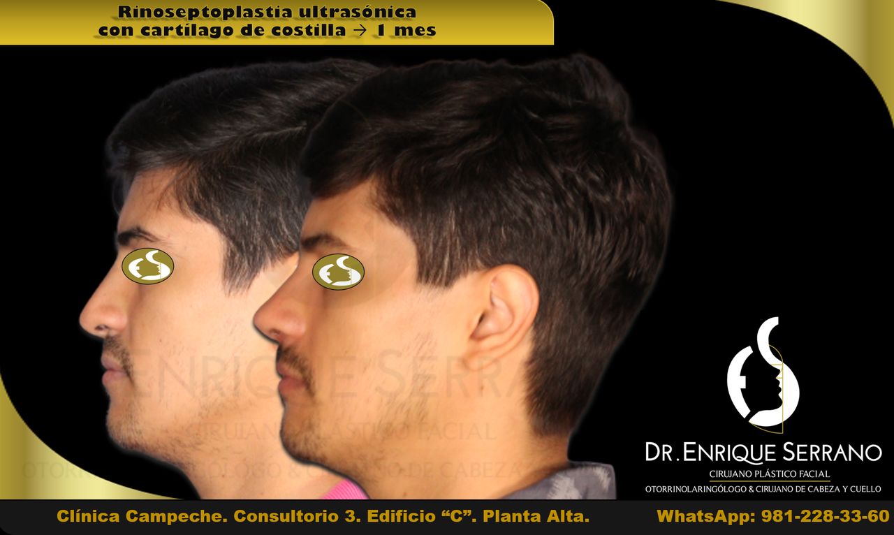 Enrique Serrano Cruz-19