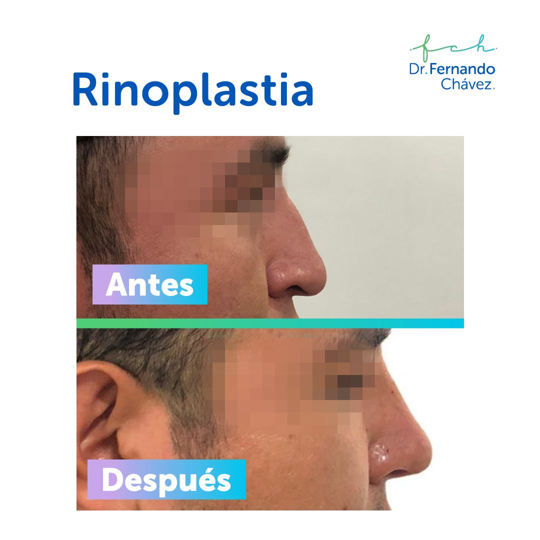 Fernando Chávez Osorio-5