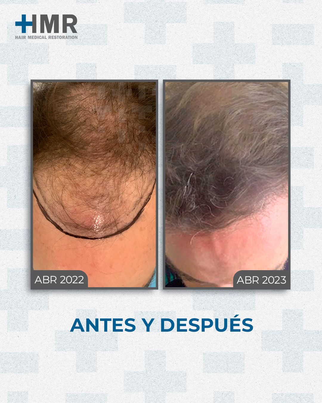 Mendelhsson Mata Cortes-4