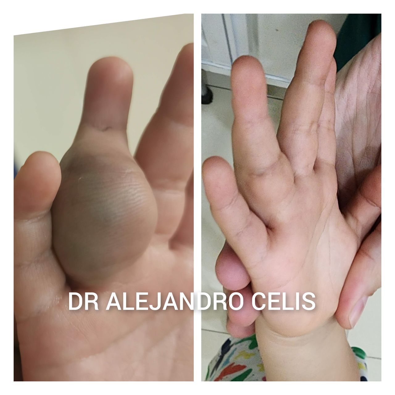 Alejandro Celis Jiménez-6