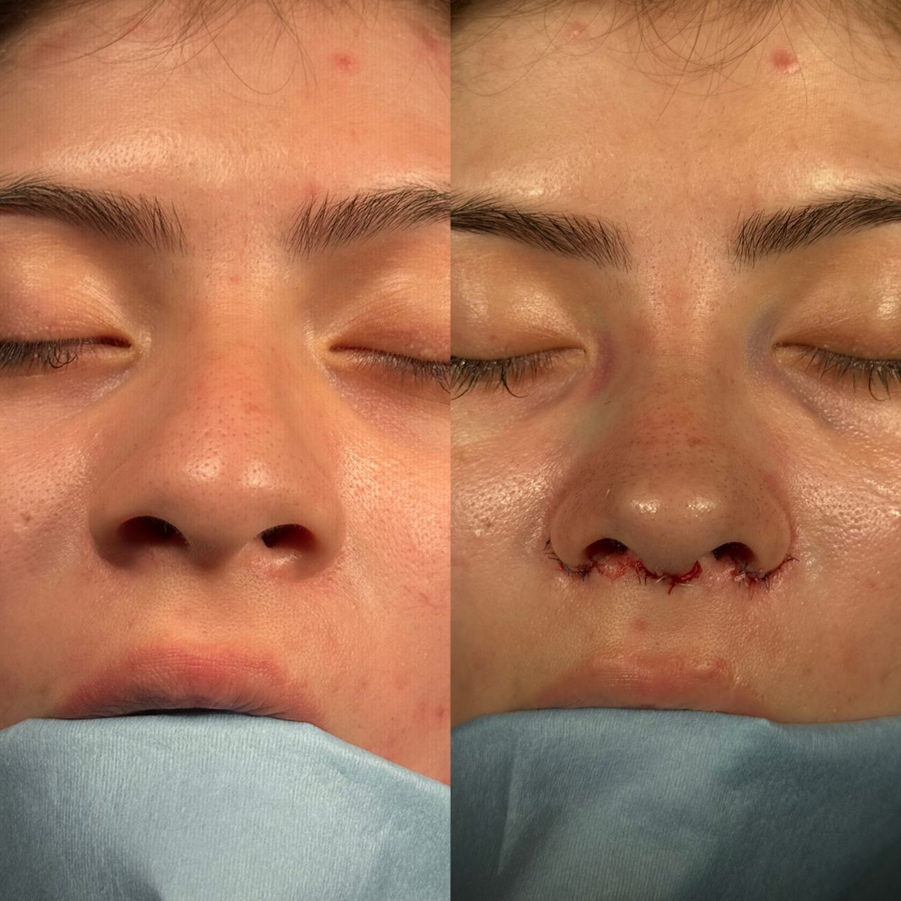 Angel Castro Urquizo-46