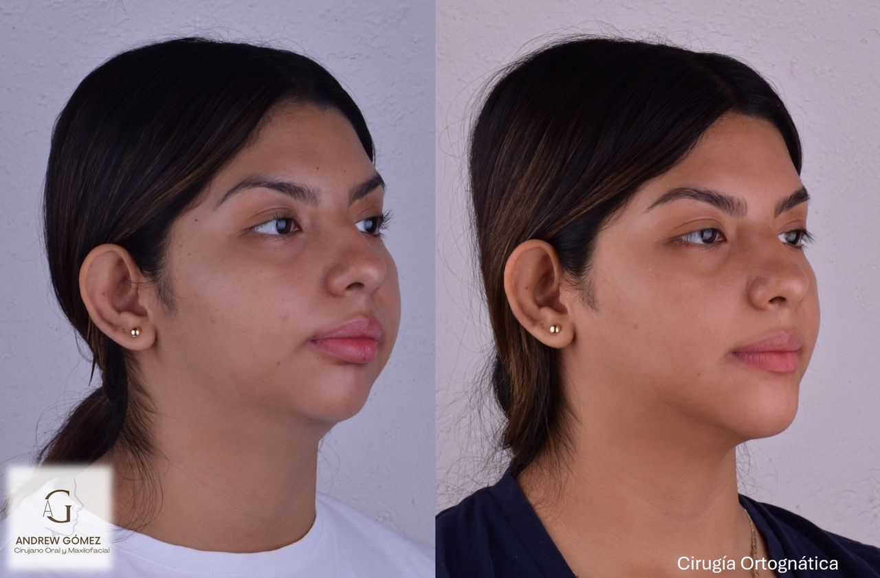 Kevin Andrew Gómez Hernández-4