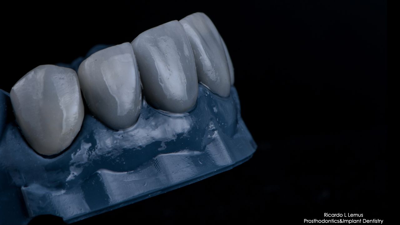 Ricardo López Lemus-101