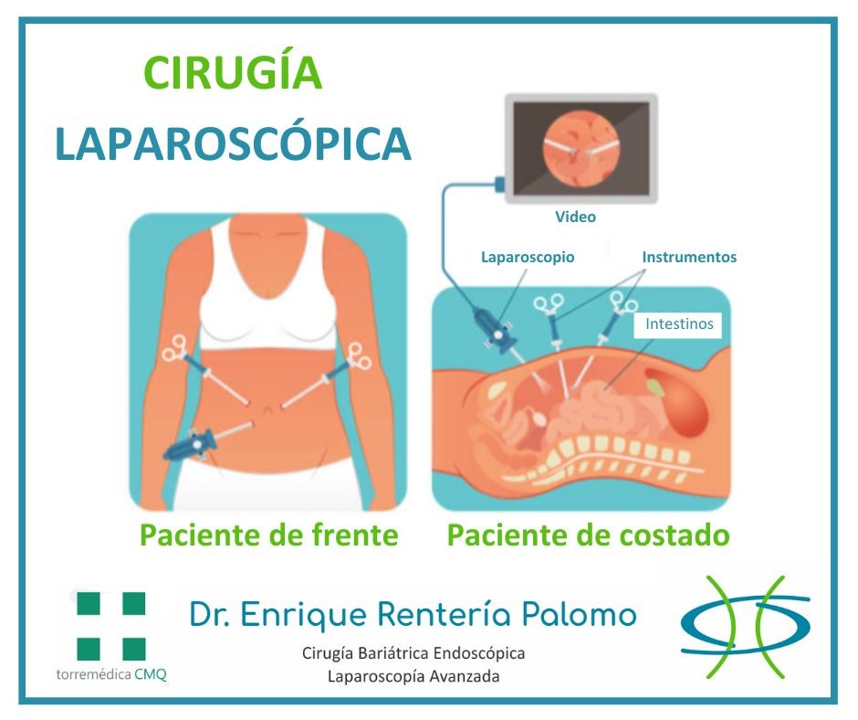 Enrique Rentería Palomo-41