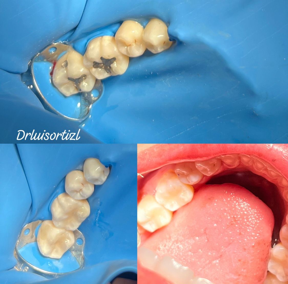 Luis Ángel Ortiz López-11