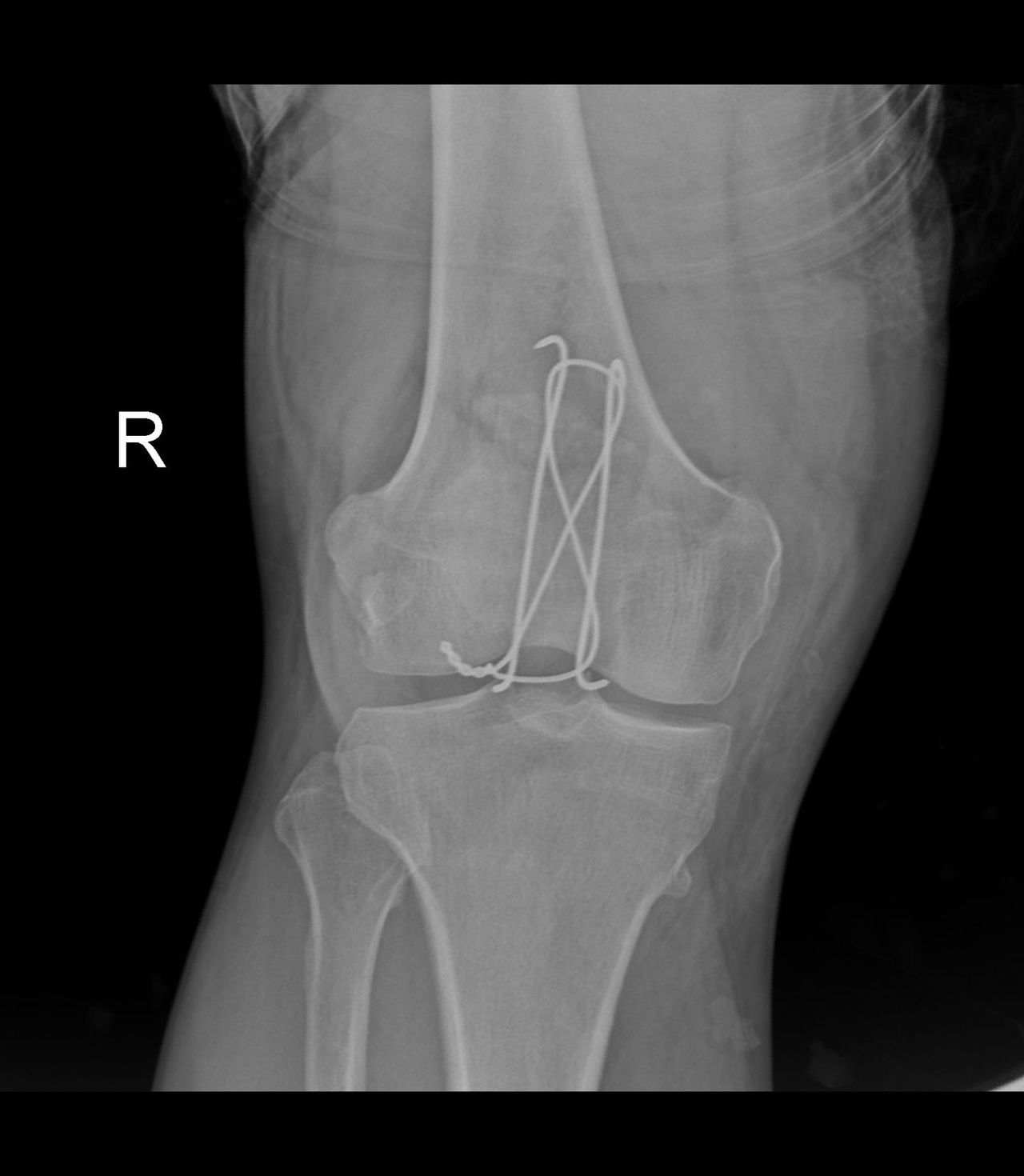 Carlos Humberto Vera Torres-10