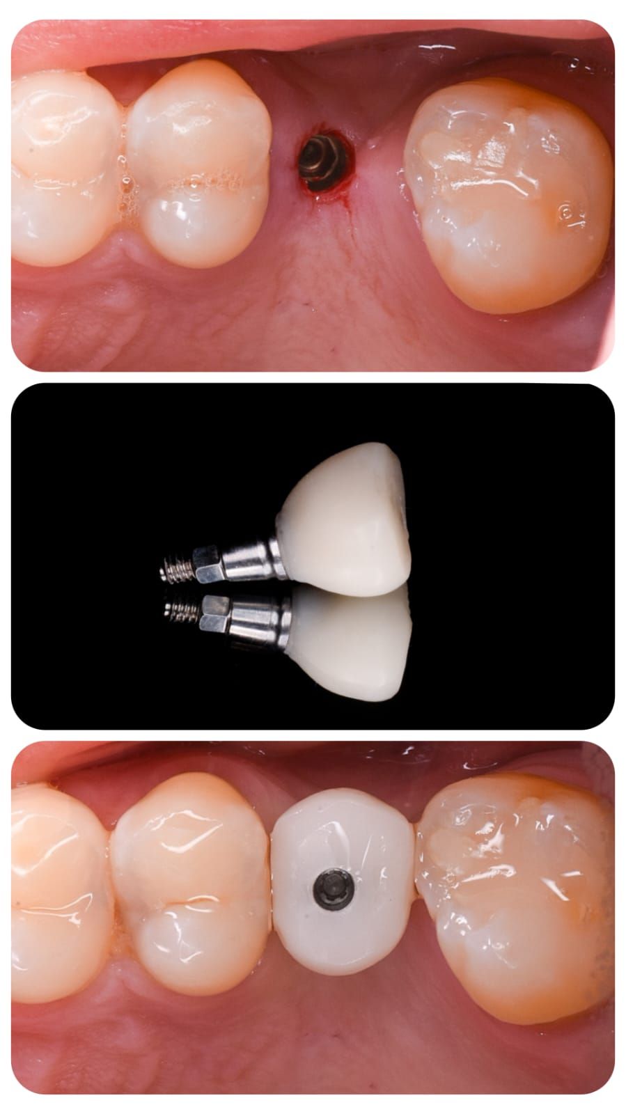 Fredy Alejandro Roblero Gónzalez-41