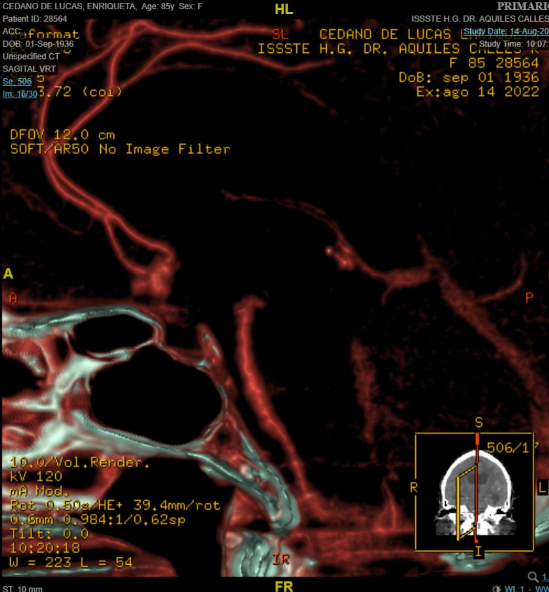 Celia Teresa De Jesús Álvarez Gamiño-28