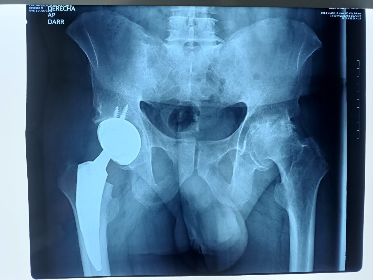 Jorge Yair Álvarez Ojeda-2