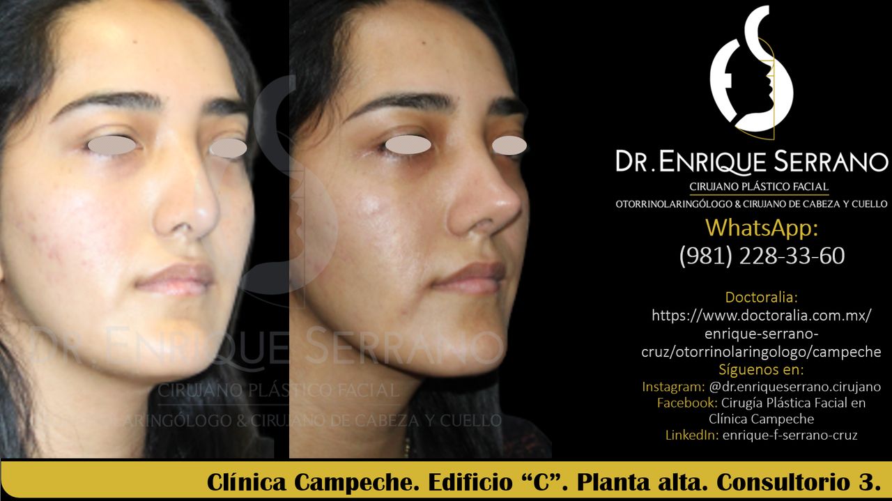 Enrique Serrano Cruz-64