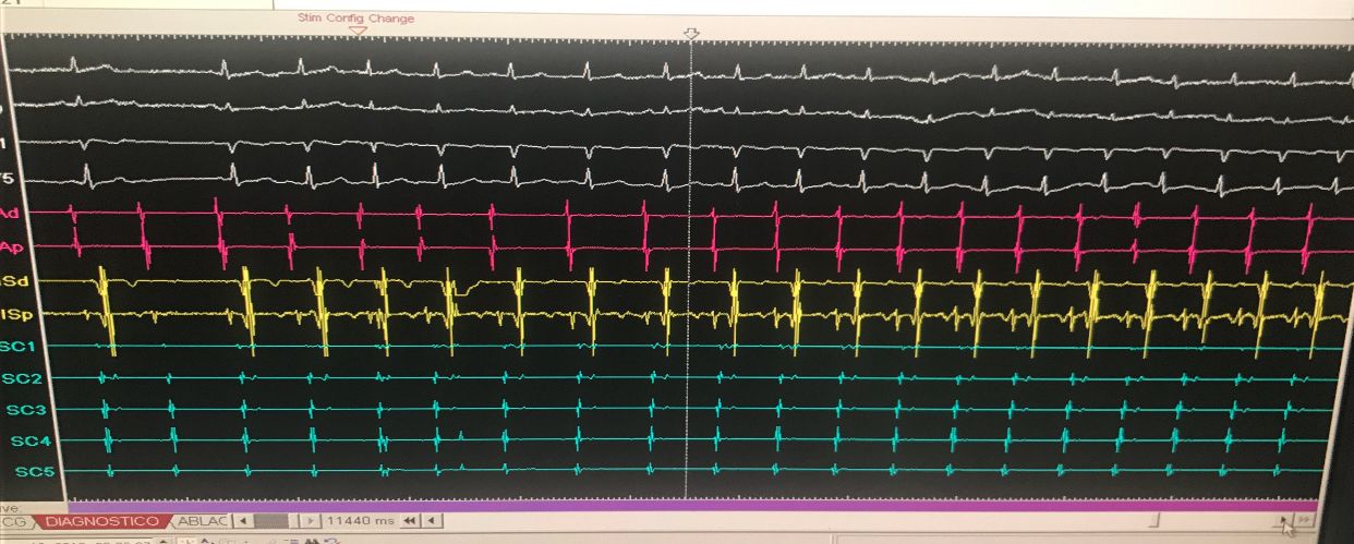 Karim Yarek Juarez Escobar-8