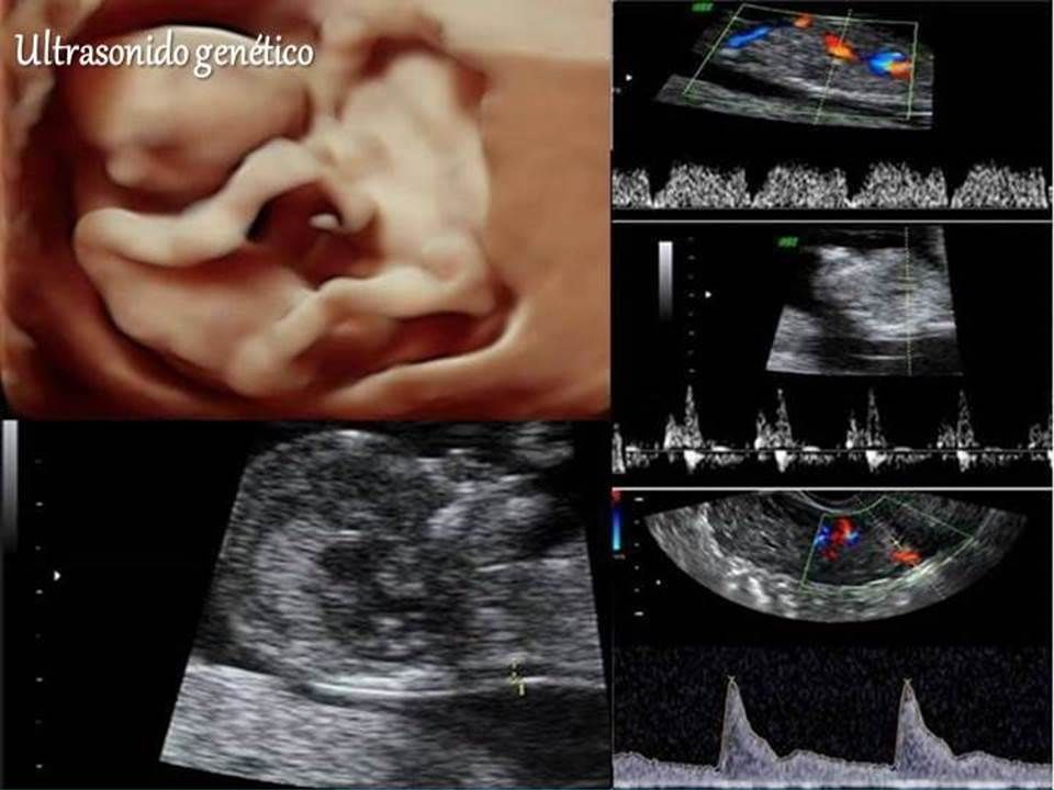 Edgar Alejandro Támez Cristerna-6