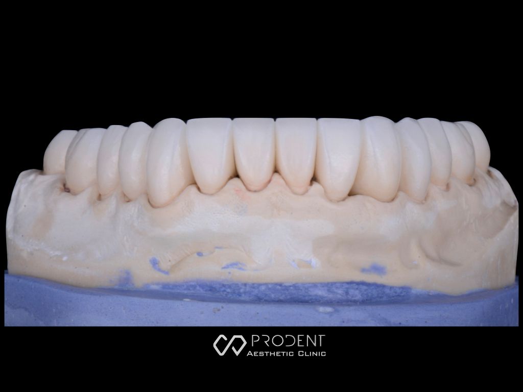 Ramiro Ivan Pérez Murillo-43