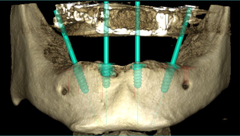 Sergio Cortes Aroche-3