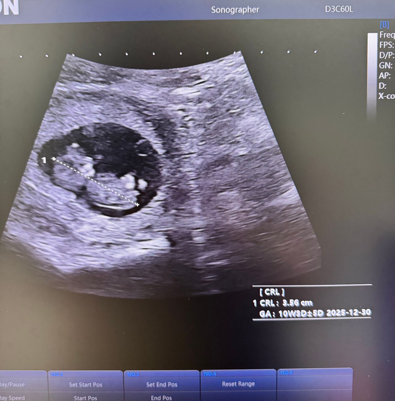 Amairani Yaneiri Mercado Rivera-4