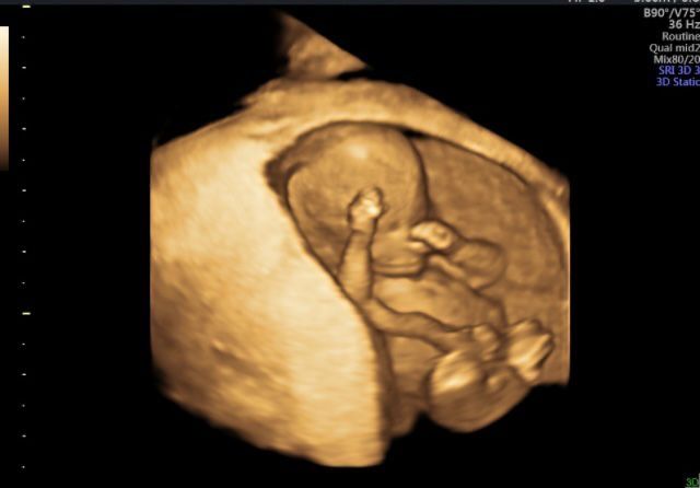 Brenda Josette López Ruiz-3