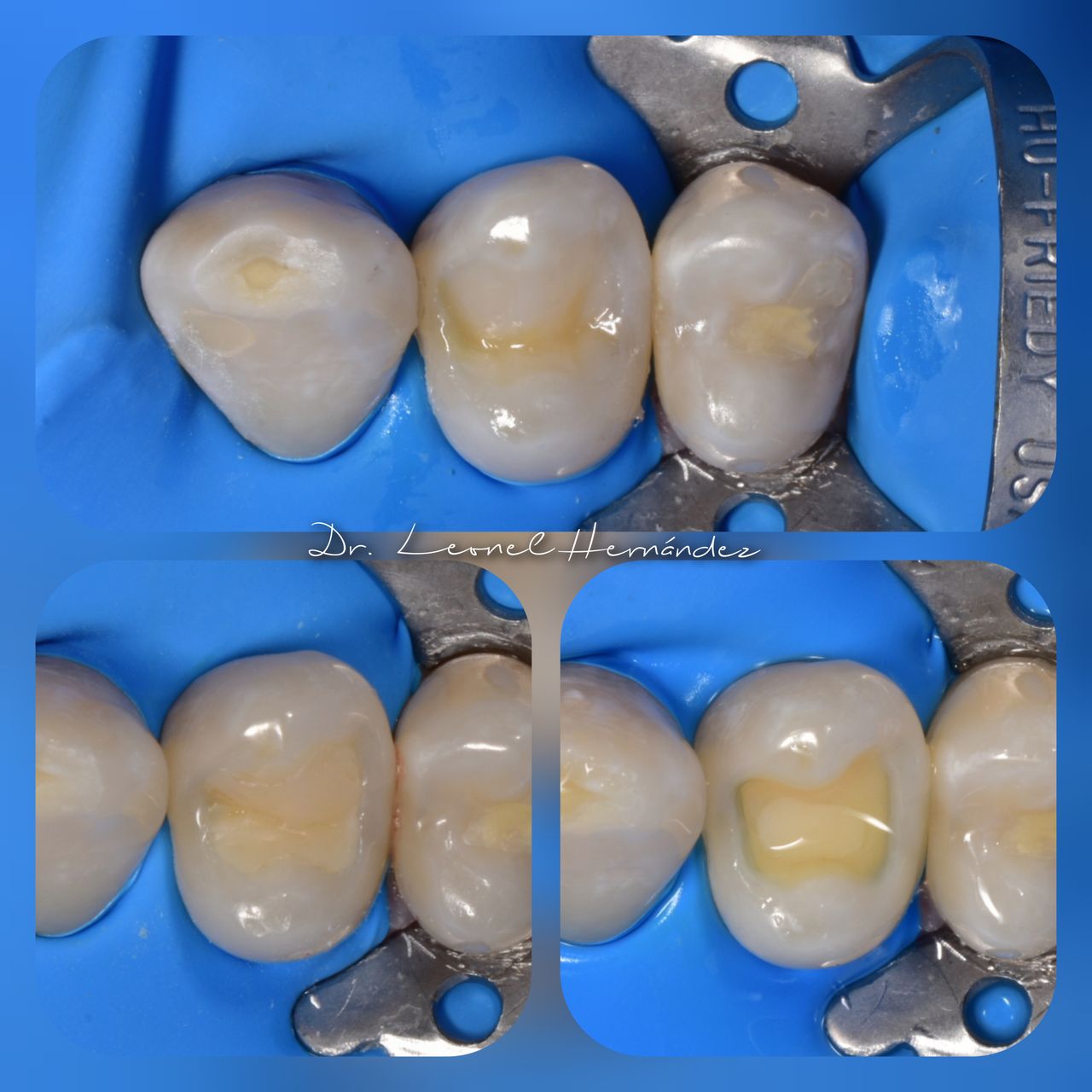 Leonel Hernández Gómez-14