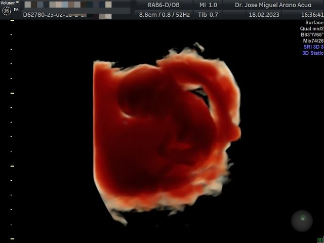 José Miguel Arano Acua-3