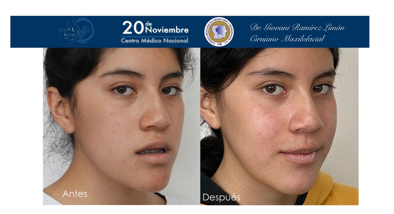 Giovani Ramírez Limón-28