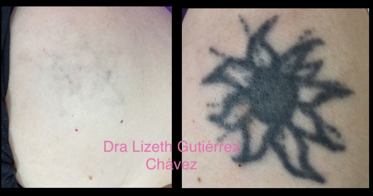 Lizeth Alejandra Gutiérrez Chavéz-2