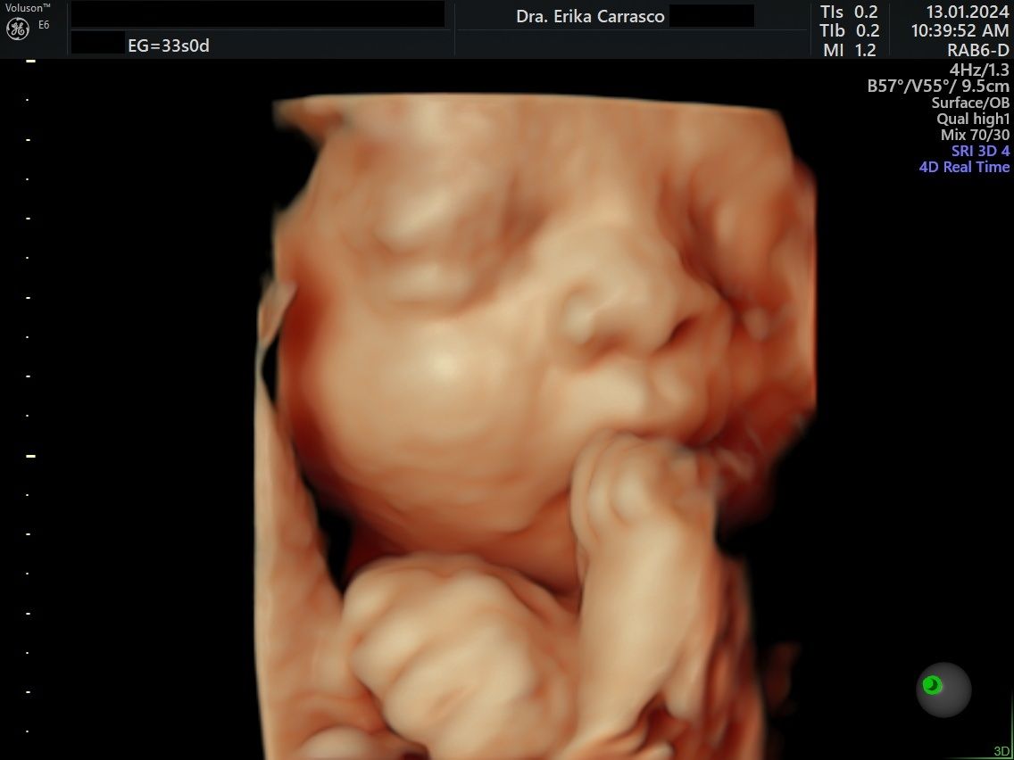 Erika Ruth Carrasco Blancas-11