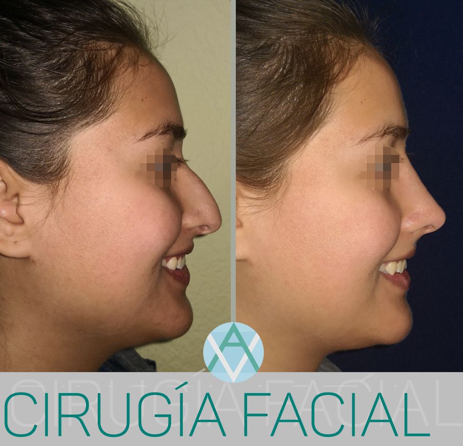 Alfonso Villaseñor Herrero-31